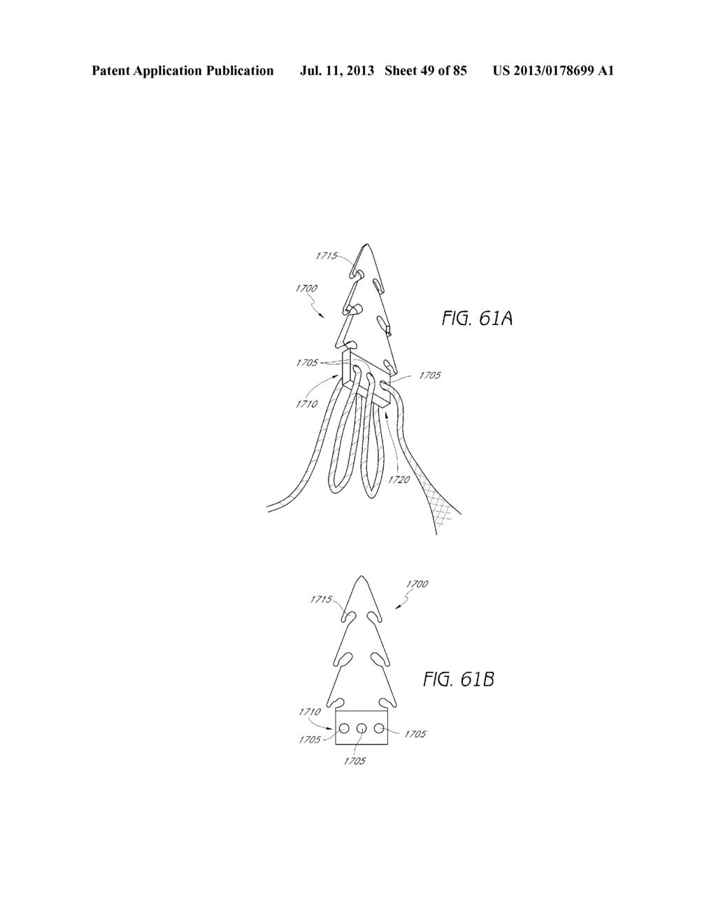 MINIMALLY INVASIVE TISSUE SUPPORT - diagram, schematic, and image 50