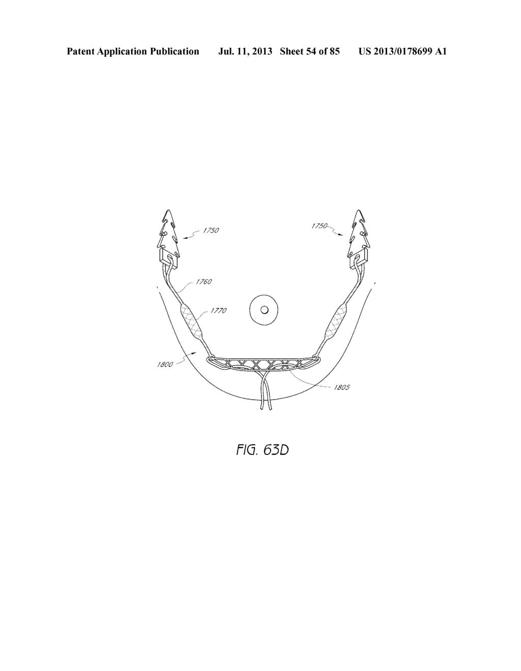 MINIMALLY INVASIVE TISSUE SUPPORT - diagram, schematic, and image 55