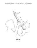 Scope Tubes, Intubation Assemblies, and Methods of Intubation diagram and image