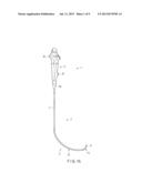 ENDOSCOPE diagram and image