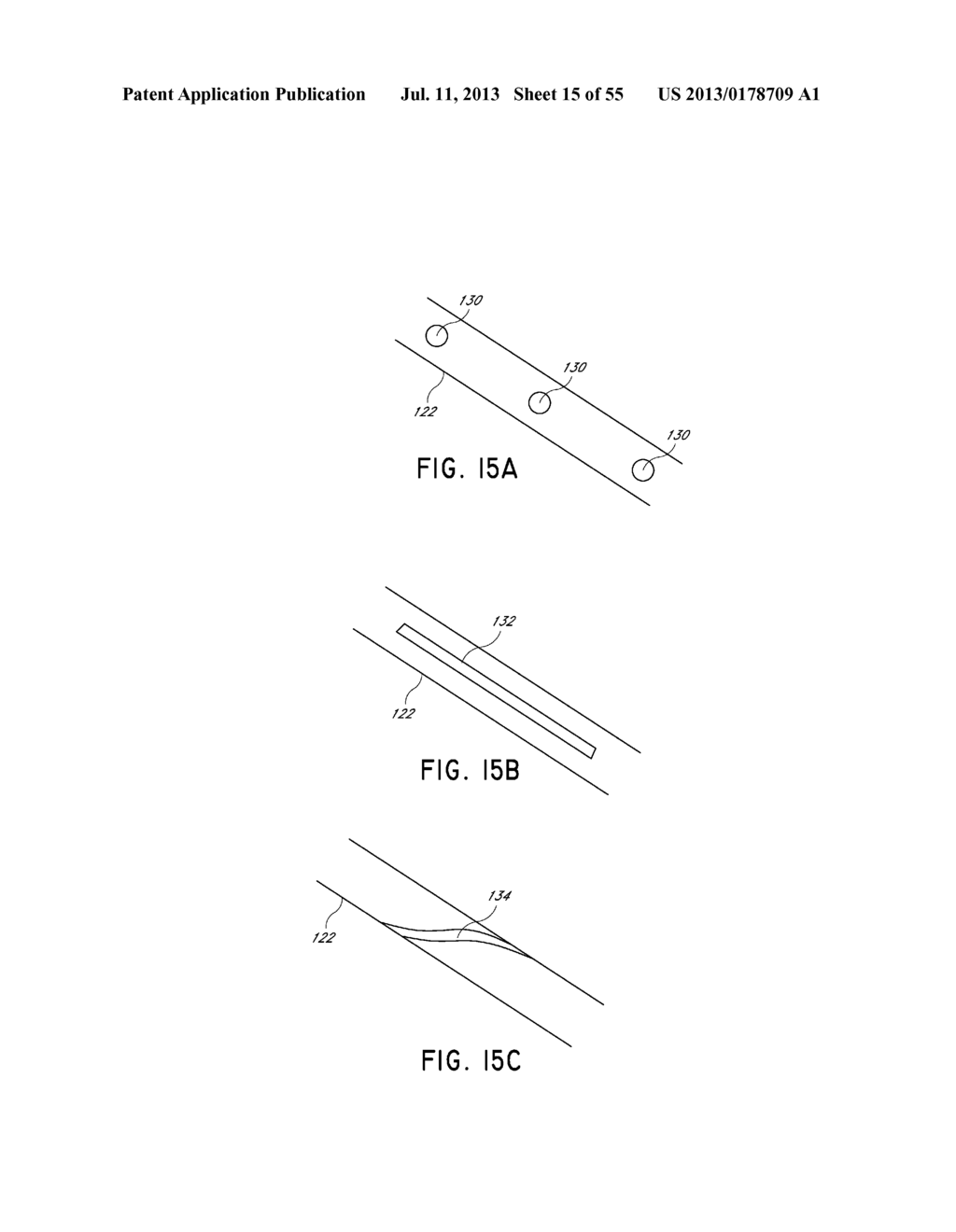 METHODS FOR THE PREVENTION OF SURGICAL SITE INFECTIONS - diagram, schematic, and image 16