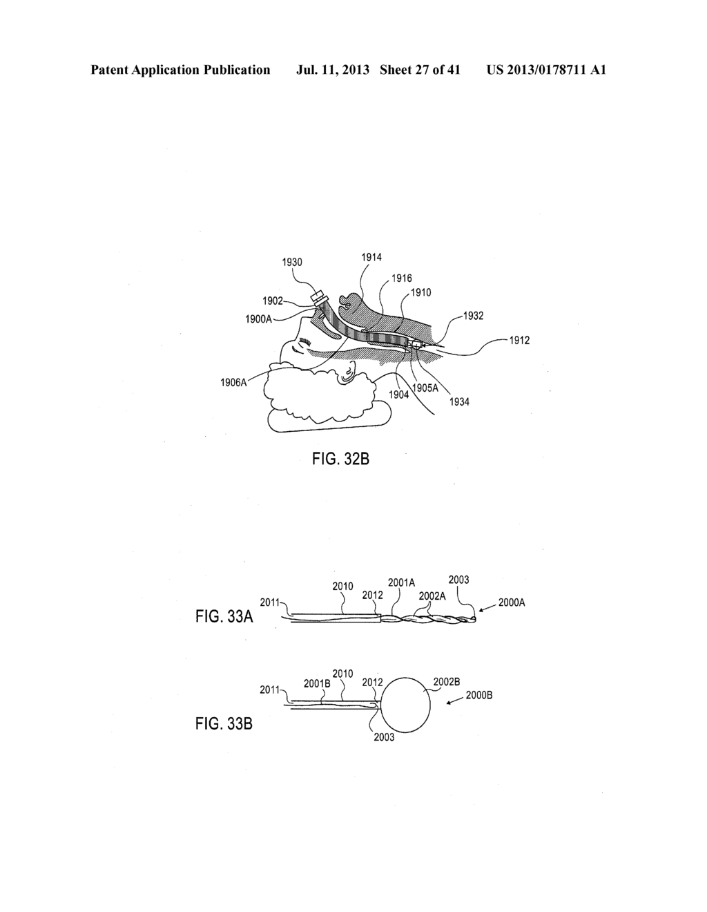 DEVICES AND METHODS FOR ENDOVASCULAR ACCESS AND THERAPY - diagram, schematic, and image 28