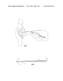 SURGICAL TONGUE DEPRESSOR diagram and image