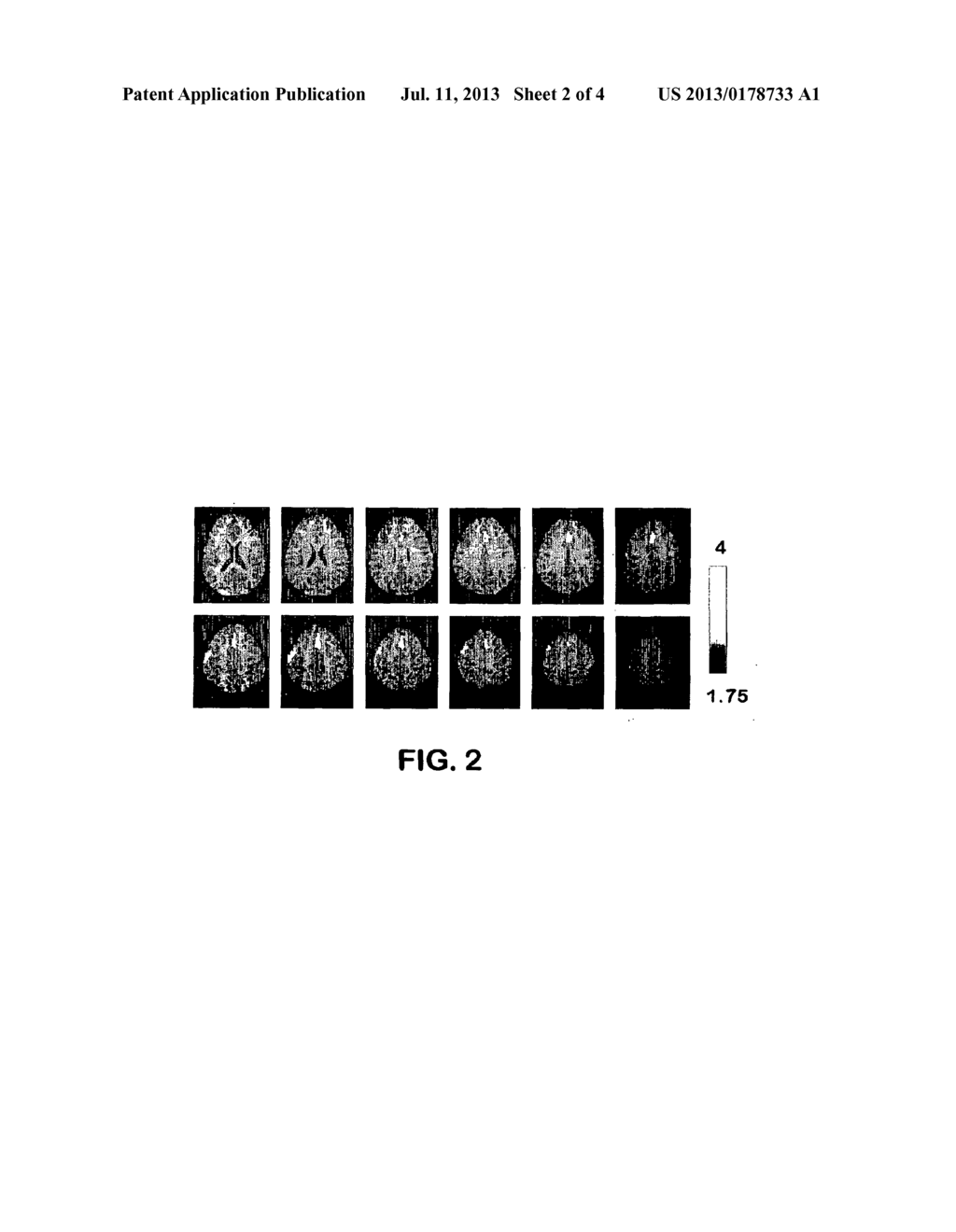 FUNCTIONAL BRAIN IMAGING FOR DETECTING AND ASSESSING DECEPTION AND     CONCEALED RECOGNITION, AND COGNITIVE/EMOTIONAL RESPONSE TO INFORMATION - diagram, schematic, and image 03