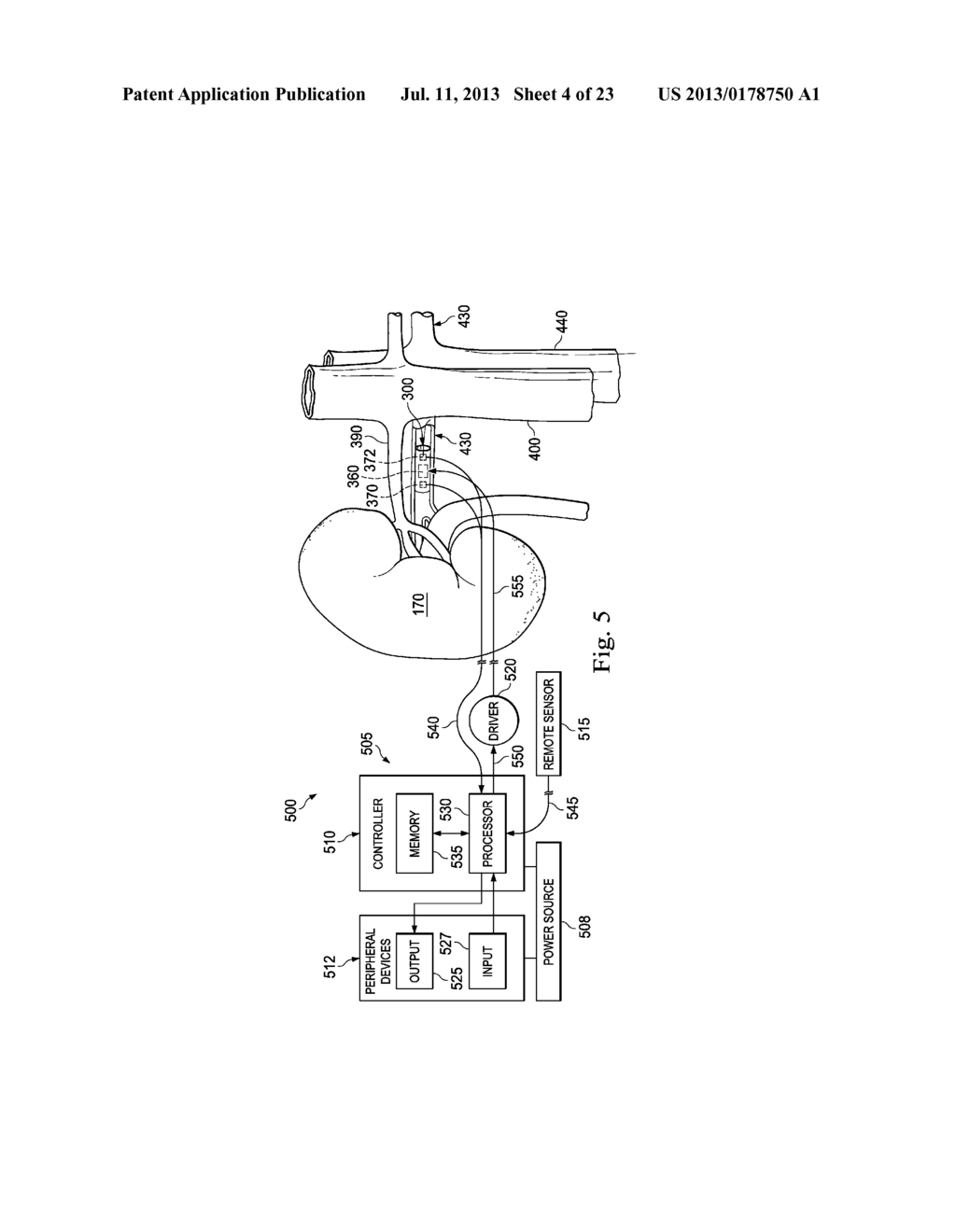 Methods and Apparatus for Regulating Blood Pressure - diagram, schematic, and image 05