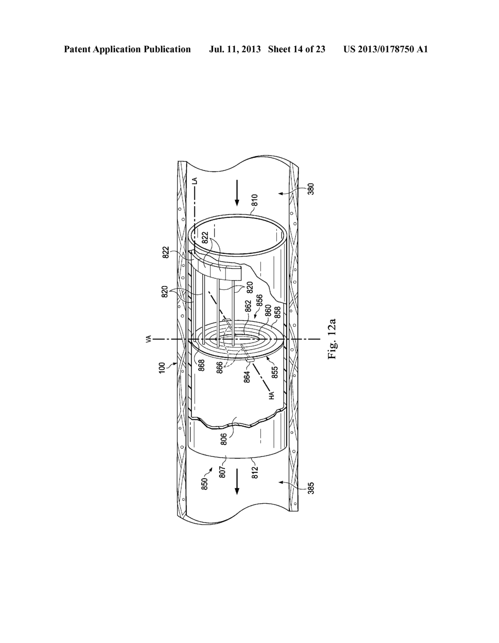 Methods and Apparatus for Regulating Blood Pressure - diagram, schematic, and image 15