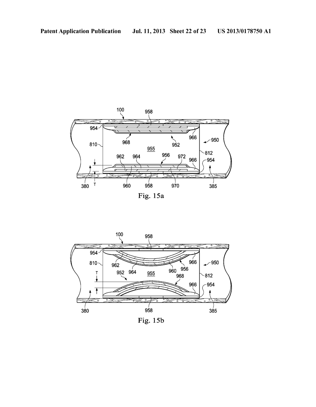 Methods and Apparatus for Regulating Blood Pressure - diagram, schematic, and image 23