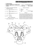 CERVICAL COLLAR WITH CABLE REEL ADJUSTMENT SYSTEM diagram and image