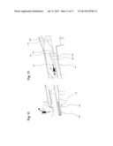 INFUSION SITE INTERFACES AND INSERTION DEVICES FOR INFUSION SITE     INTERFACES diagram and image