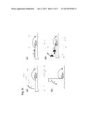 INFUSION SITE INTERFACES AND INSERTION DEVICES FOR INFUSION SITE     INTERFACES diagram and image