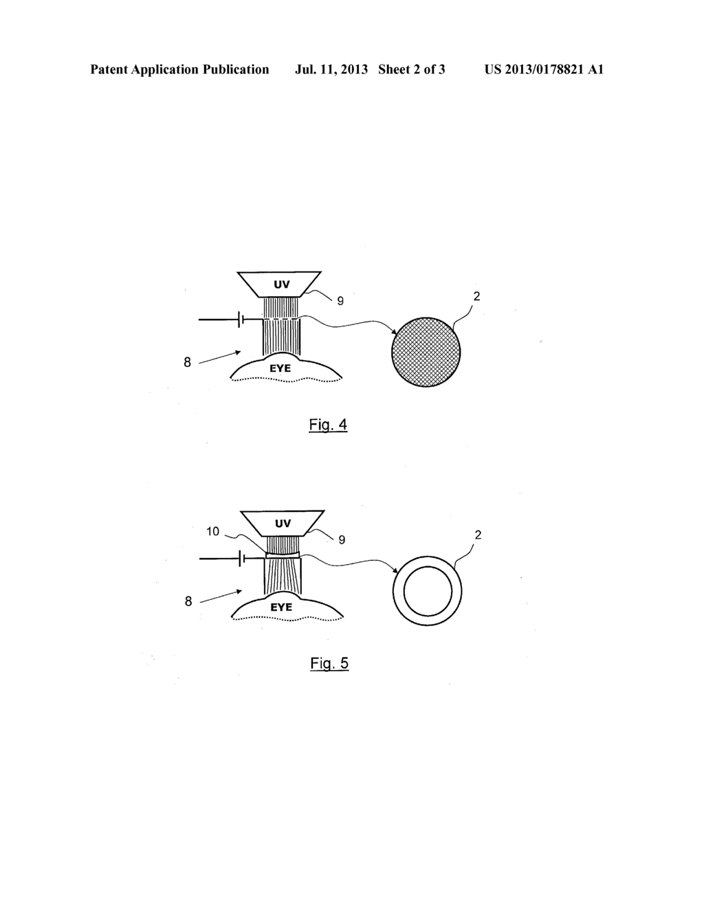 DEVICE AND METHOD FOR CORNEAL DELIVERY OF RIBOFLAVIN BY IONTOPHORESIS FOR     THE TREATMENT OF KERATOCONUS - diagram, schematic, and image 03