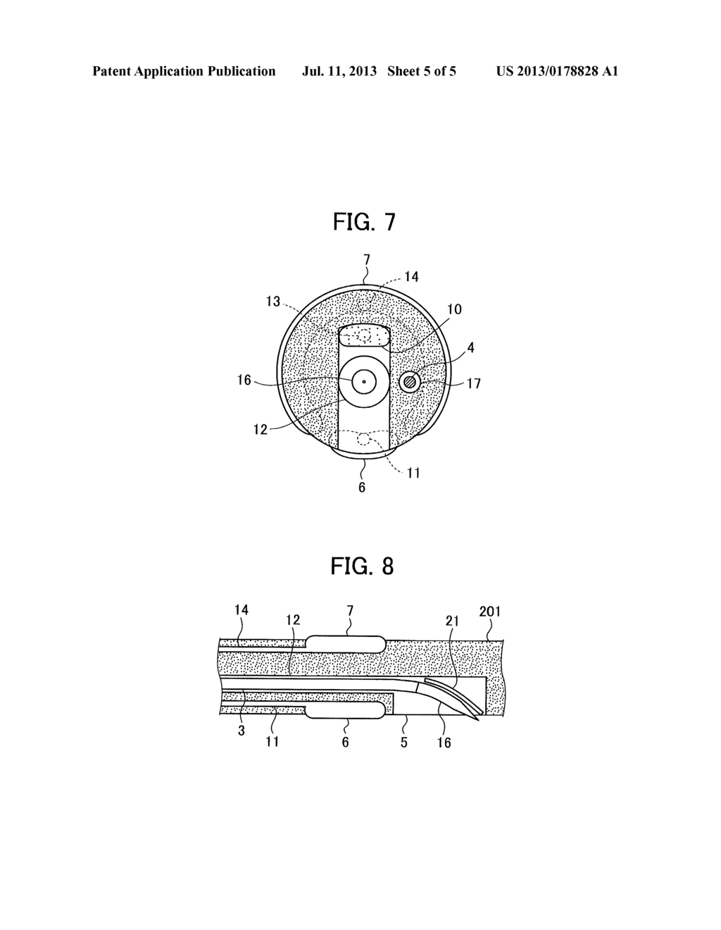 DEVICE FOR MEDICAL TREATMENT - diagram, schematic, and image 06