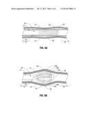 System and Method For Treating Tissue Using An Expandable Antenna diagram and image