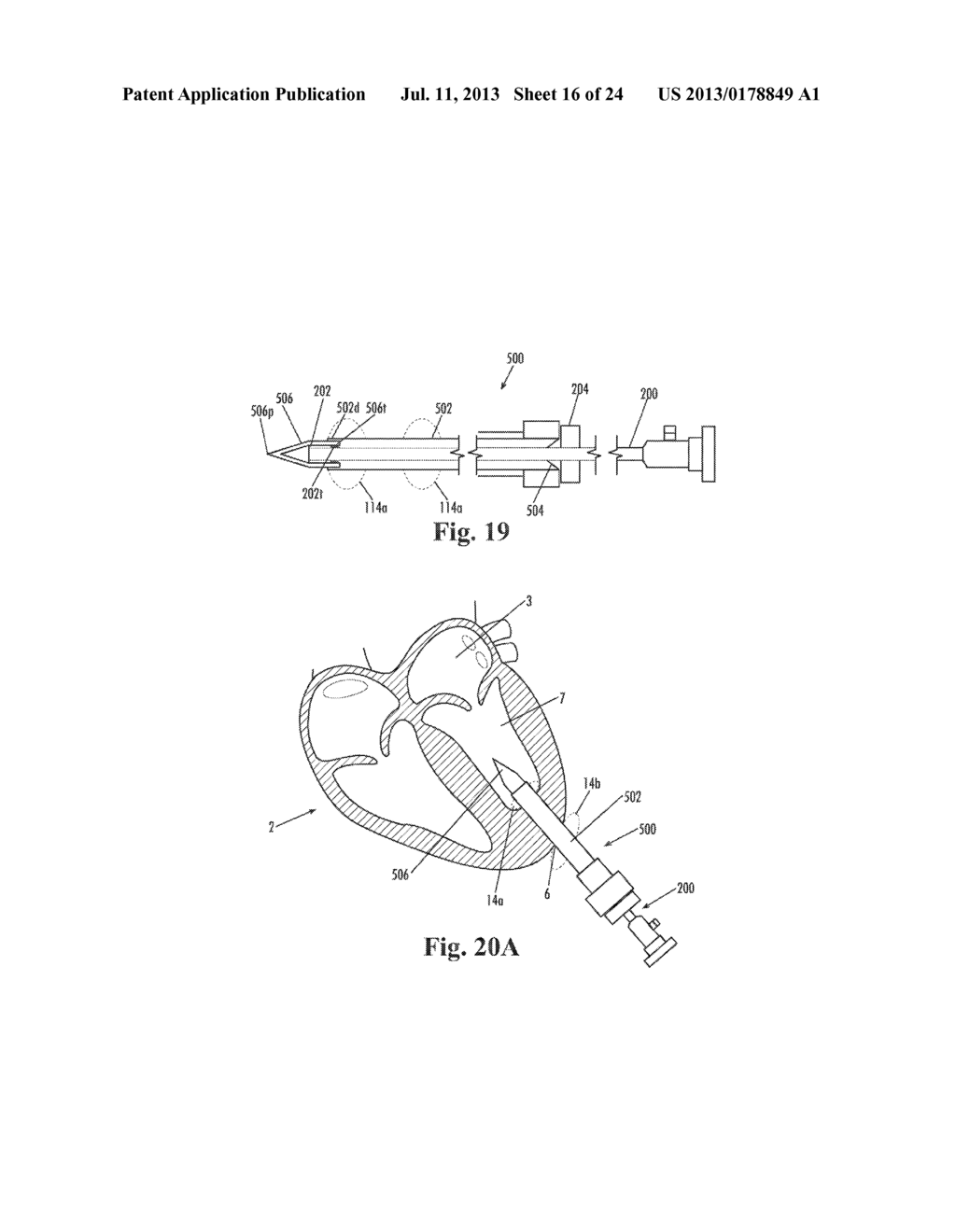 DEVICES AND METHODS FOR MINIMALLY-INVASIVE SURGICAL PROCEDURES - diagram, schematic, and image 17