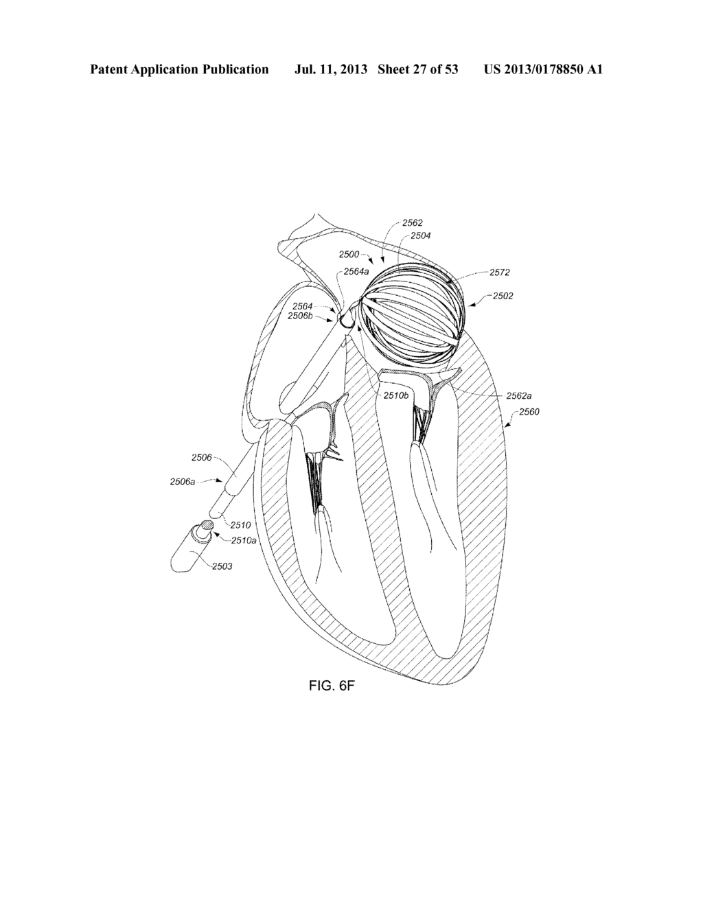 ENHANCED MEDICAL DEVICE FOR USE IN BODILY CAVITIES, FOR EXAMPLE AN ATRIUM - diagram, schematic, and image 28