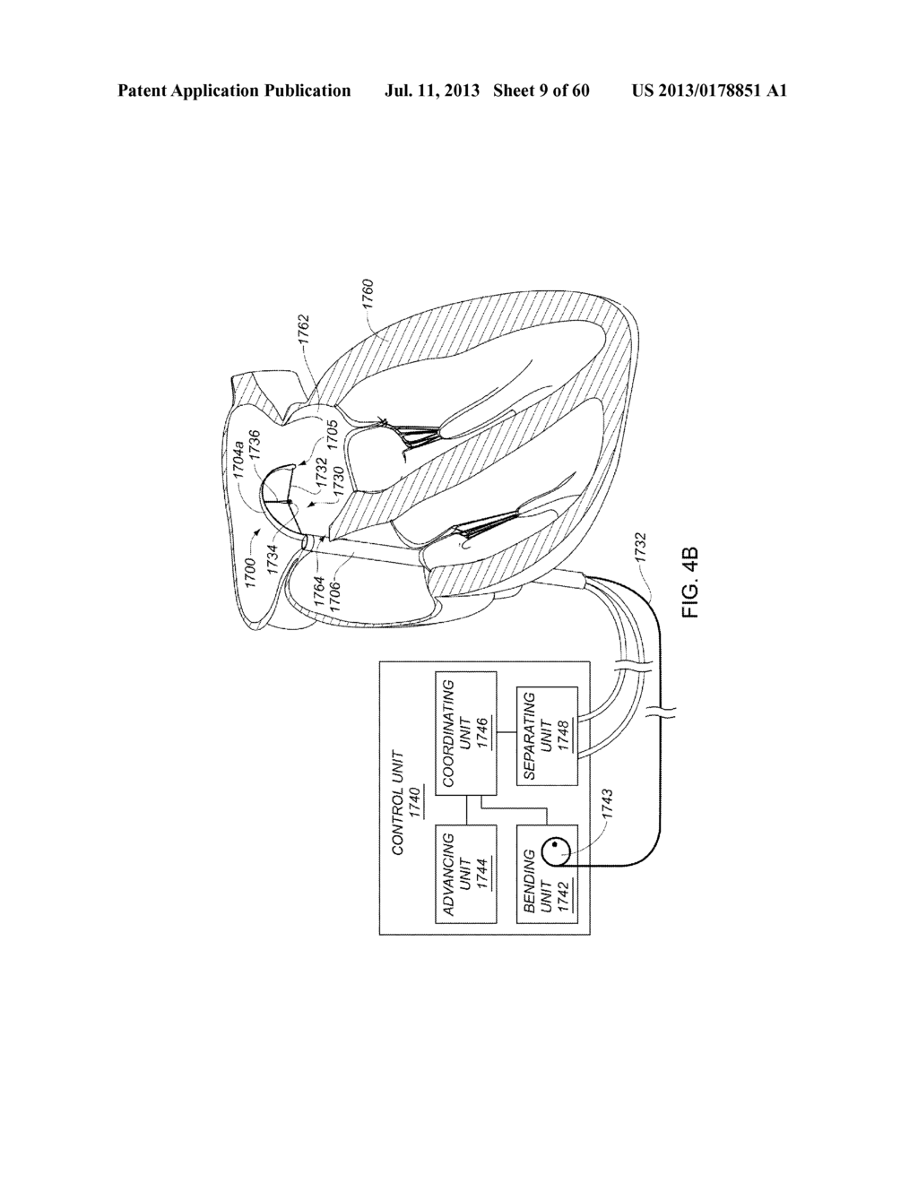 ENHANCED MEDICAL DEVICE FOR USE IN BODILY CAVITIES, FOR EXAMPLE AN ATRIUM - diagram, schematic, and image 10