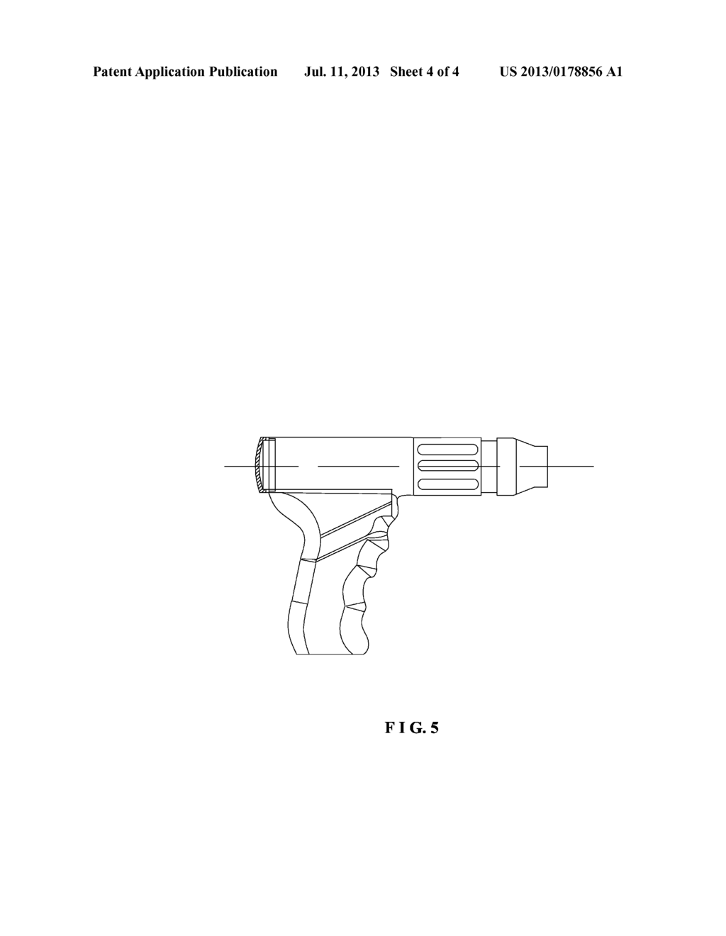 CRANIOTOMY DRILL - diagram, schematic, and image 05