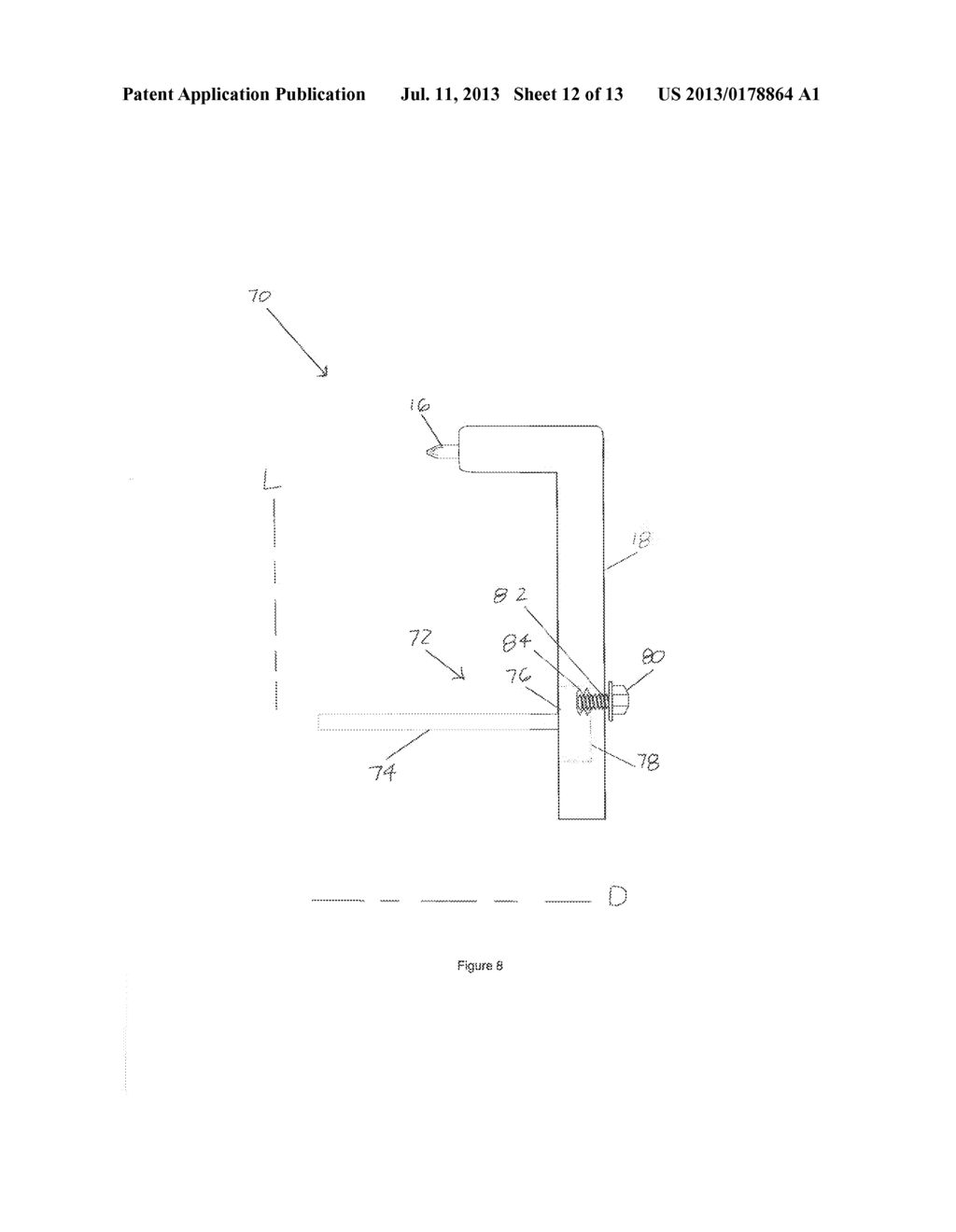 METHOD AND APPARATUS FOR POSITIONING AND PLACEMENT OF A SURGICAL DEVICE - diagram, schematic, and image 13