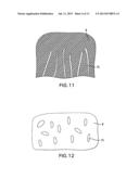 COMPOSITE IMPLANT diagram and image