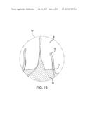 COMPOSITE IMPLANT diagram and image