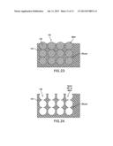 COMPOSITE IMPLANT diagram and image