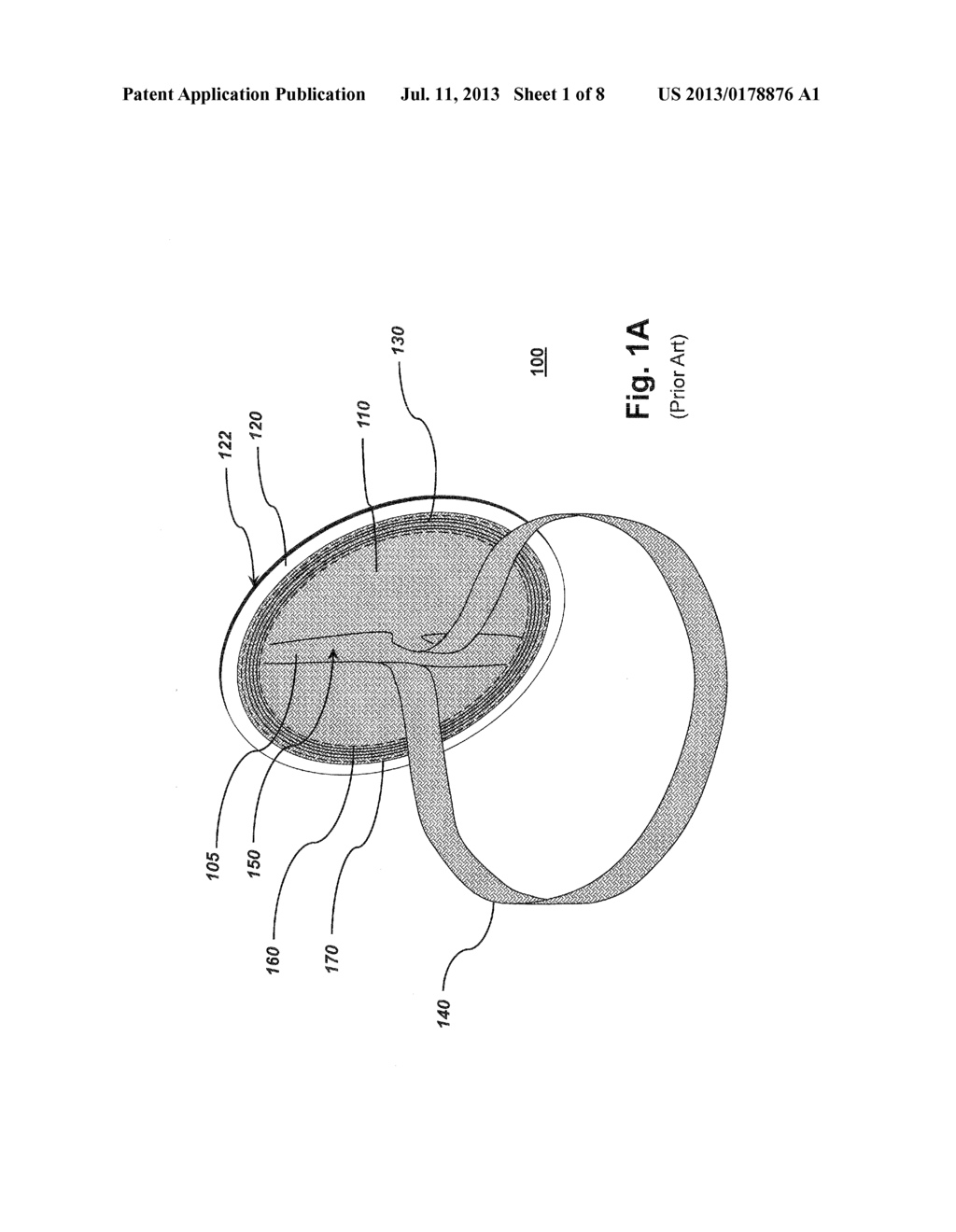 HERNIA PATCH - diagram, schematic, and image 02