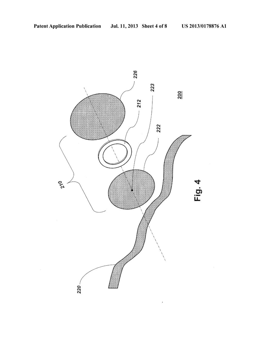 HERNIA PATCH - diagram, schematic, and image 05