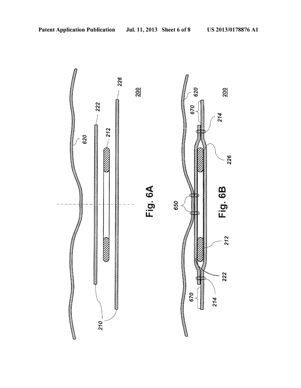 HERNIA PATCH - diagram, schematic, and image 07