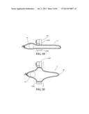 Methods, Instruments and Devices for Extragastric Reduction of Stomach     Volume diagram and image