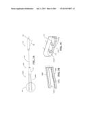 Methods, Instruments and Devices for Extragastric Reduction of Stomach     Volume diagram and image