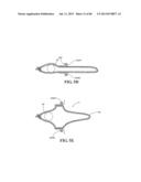 Methods, Instruments and Devices for Extragastric Reduction of Stomach     Volume diagram and image