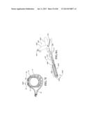 Methods, Instruments and Devices for Extragastric Reduction of Stomach     Volume diagram and image