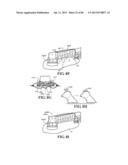 Methods, Instruments and Devices for Extragastric Reduction of Stomach     Volume diagram and image