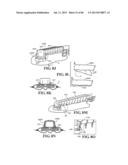 Methods, Instruments and Devices for Extragastric Reduction of Stomach     Volume diagram and image