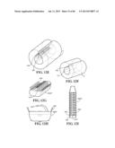 Methods, Instruments and Devices for Extragastric Reduction of Stomach     Volume diagram and image