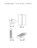 Methods, Instruments and Devices for Extragastric Reduction of Stomach     Volume diagram and image