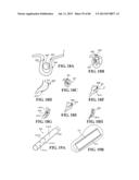 Methods, Instruments and Devices for Extragastric Reduction of Stomach     Volume diagram and image