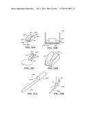 Methods, Instruments and Devices for Extragastric Reduction of Stomach     Volume diagram and image