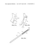 Methods, Instruments and Devices for Extragastric Reduction of Stomach     Volume diagram and image