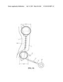 Methods, Instruments and Devices for Extragastric Reduction of Stomach     Volume diagram and image