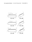 Methods, Instruments and Devices for Extragastric Reduction of Stomach     Volume diagram and image