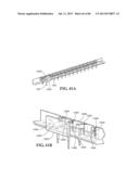 Methods, Instruments and Devices for Extragastric Reduction of Stomach     Volume diagram and image