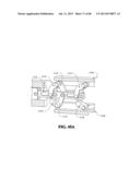 Methods, Instruments and Devices for Extragastric Reduction of Stomach     Volume diagram and image