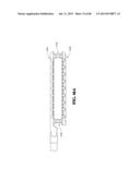 Methods, Instruments and Devices for Extragastric Reduction of Stomach     Volume diagram and image