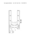 Methods, Instruments and Devices for Extragastric Reduction of Stomach     Volume diagram and image