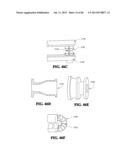 Methods, Instruments and Devices for Extragastric Reduction of Stomach     Volume diagram and image