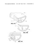 Methods, Instruments and Devices for Extragastric Reduction of Stomach     Volume diagram and image