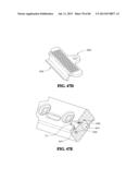 Methods, Instruments and Devices for Extragastric Reduction of Stomach     Volume diagram and image