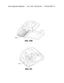 Methods, Instruments and Devices for Extragastric Reduction of Stomach     Volume diagram and image