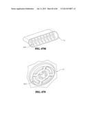 Methods, Instruments and Devices for Extragastric Reduction of Stomach     Volume diagram and image